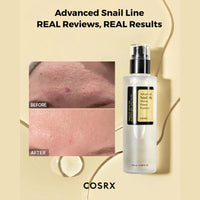Thumbnail for COSRX_Advanced Snail 96 Mucin Power Essence_Cosmetic World