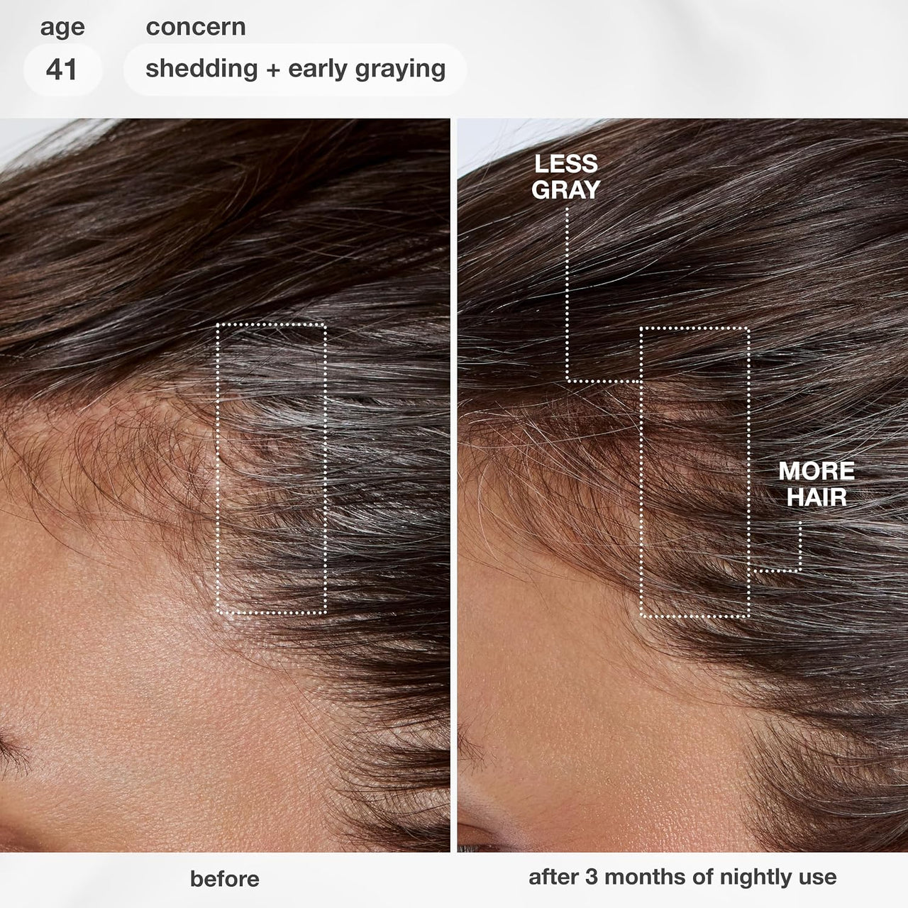 FutureIQ Biomimetisches Haarserum für längeres Haar