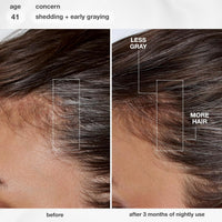 Thumbnail for FutureIQ Biomimetisches Haarserum für längeres Haar