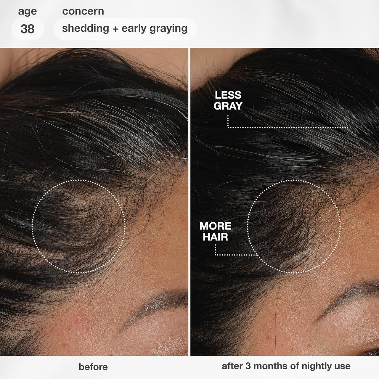 FutureIQ Biomimetisches Haarserum für längeres Haar