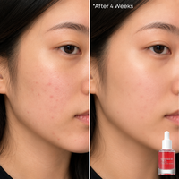 Thumbnail for Niacinamide 10% + TXA 4% Dark Spot Correcting Serum