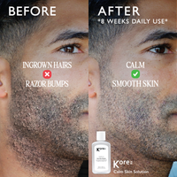 Thumbnail for Centella Calm Skin Solution