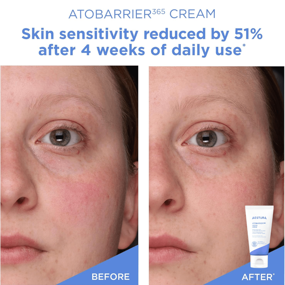 Aestura_ATOBARRIER365 Cream with Ceramides_Cosmetic World