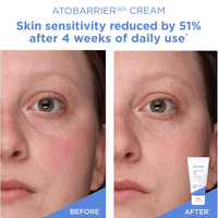 Thumbnail for Aestura_ATOBARRIER365 Cream with Ceramides_Cosmetic World