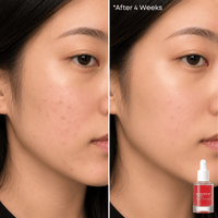 Thumbnail for Anua_Niacinamide 10% + TXA 4% Dark Spot Correcting Serum_Cosmetic World