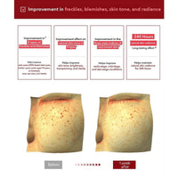 Thumbnail for Centellian24_Madeca Time Reverse Cream_Cosmetic World