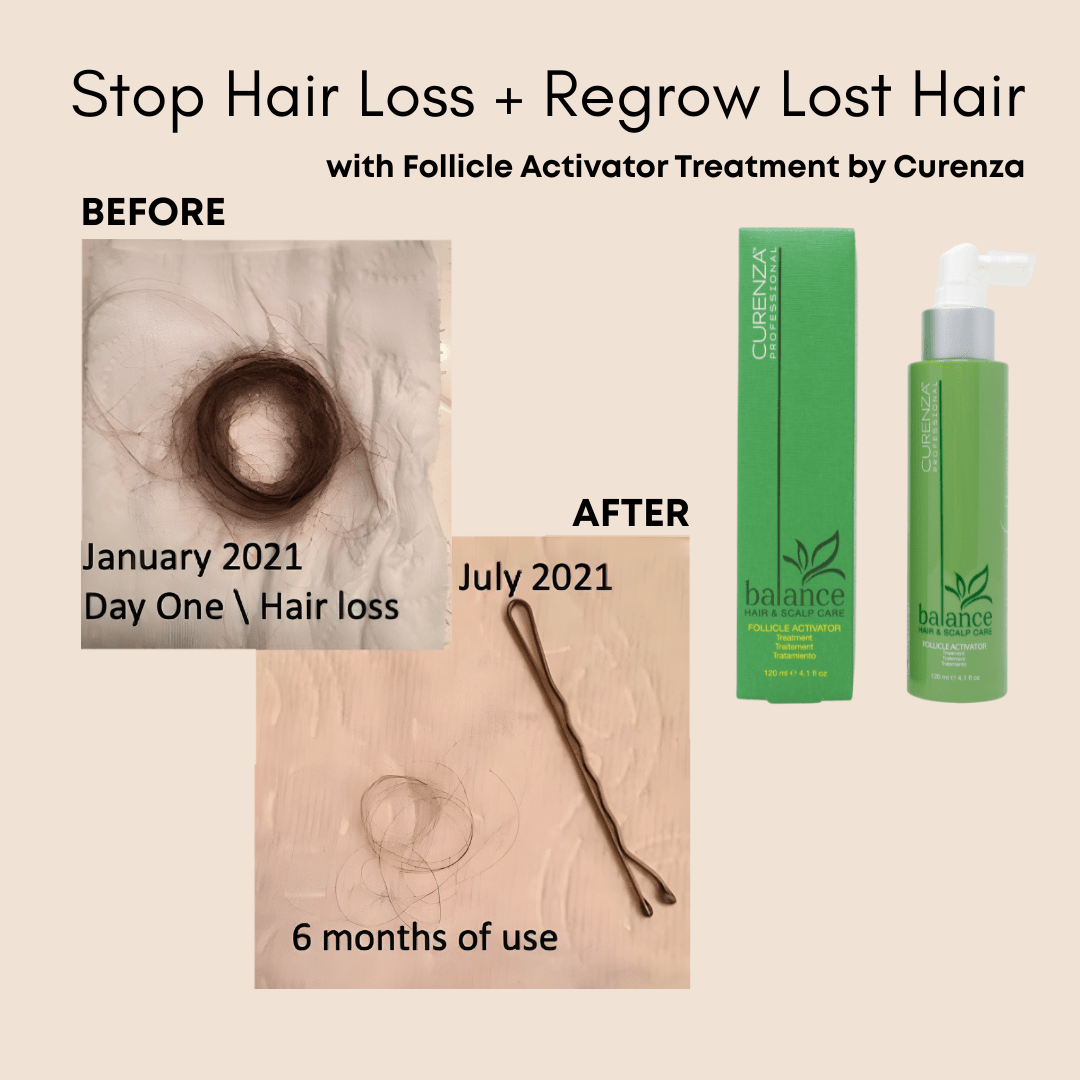 Curenza Professional_Follicle Activator Treatment_Cosmetic World