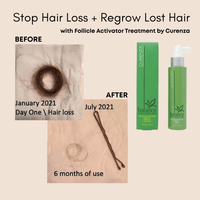 Thumbnail for Curenza Professional_Follicle Activator Treatment_Cosmetic World