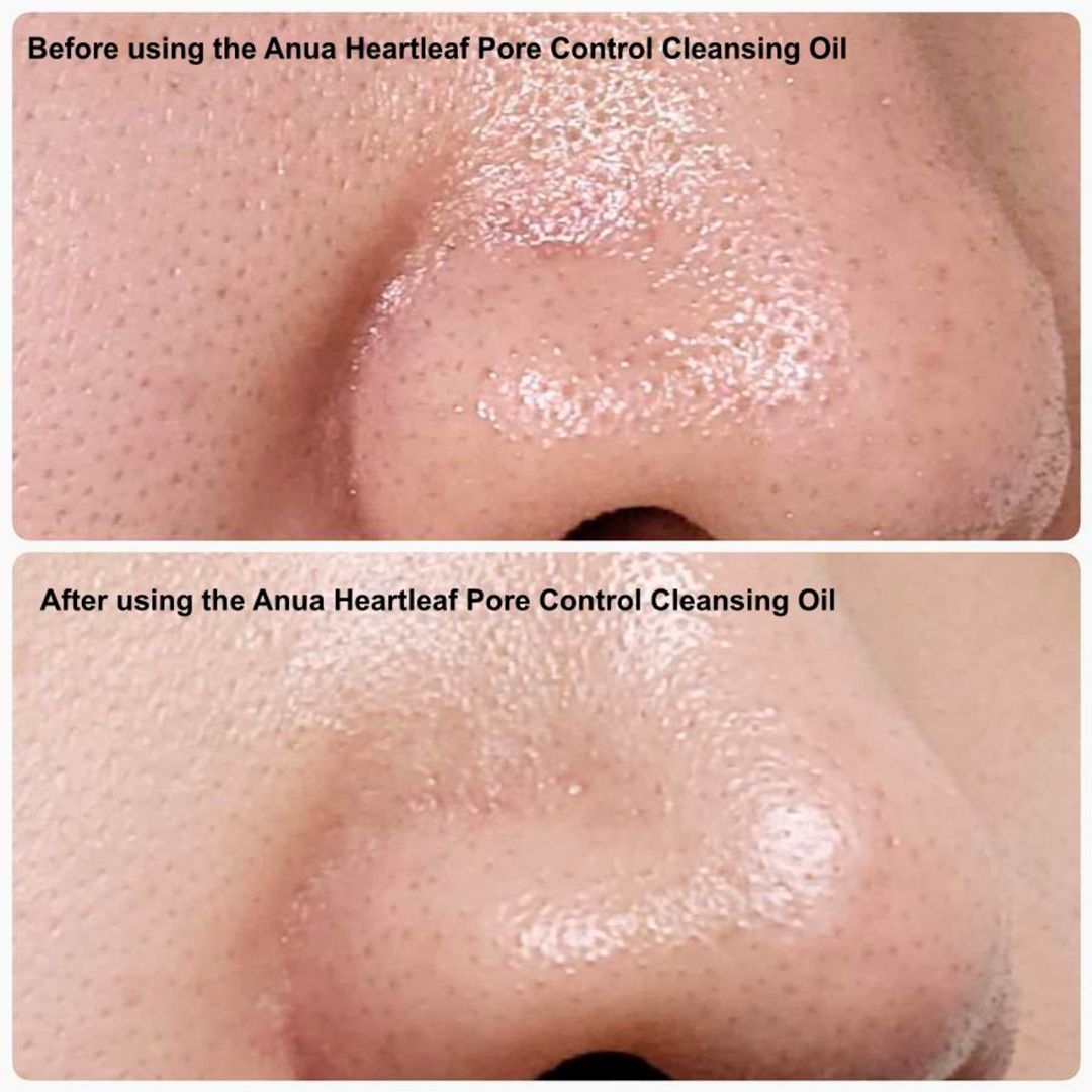 ANUA_Heartleaf Pore Control Cleansing Oil_Cosmetic World