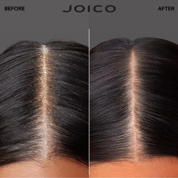 JOICO_Scalp Vitality Kit_Cosmetic World