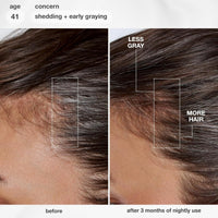 Thumbnail for K18_FutureIQ Biomimetic Hair Longevity Serum_Cosmetic World