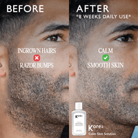 Thumbnail for KORERX_Centella Calm Skin Solution_Cosmetic World