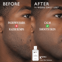 Thumbnail for KORERX_Centella Calm Skin Solution_Cosmetic World
