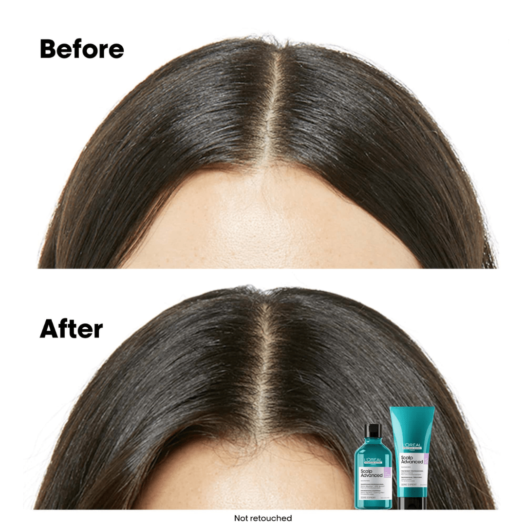 L'Oreal Professionnel_Scalp Advanced Anti-Discomfort Shampoo_Cosmetic World