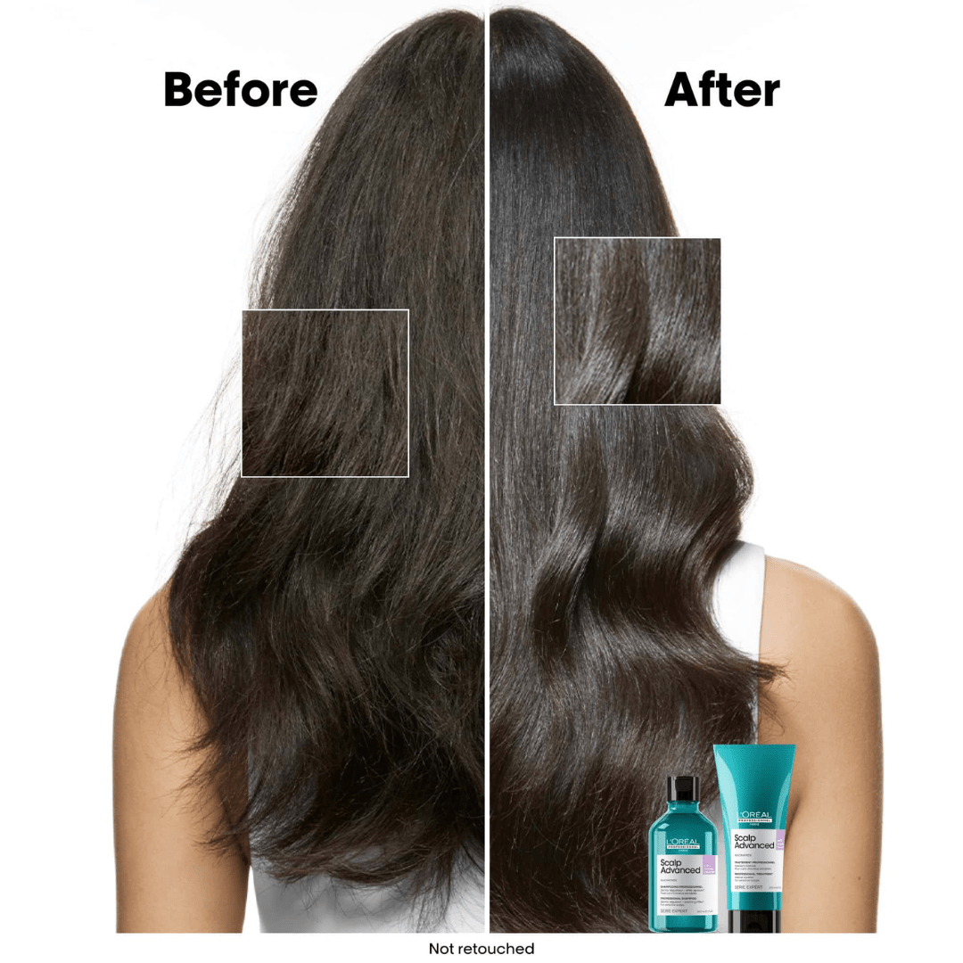 L'Oreal Professionnel_Scalp Advanced Anti-Discomfort Shampoo_Cosmetic World