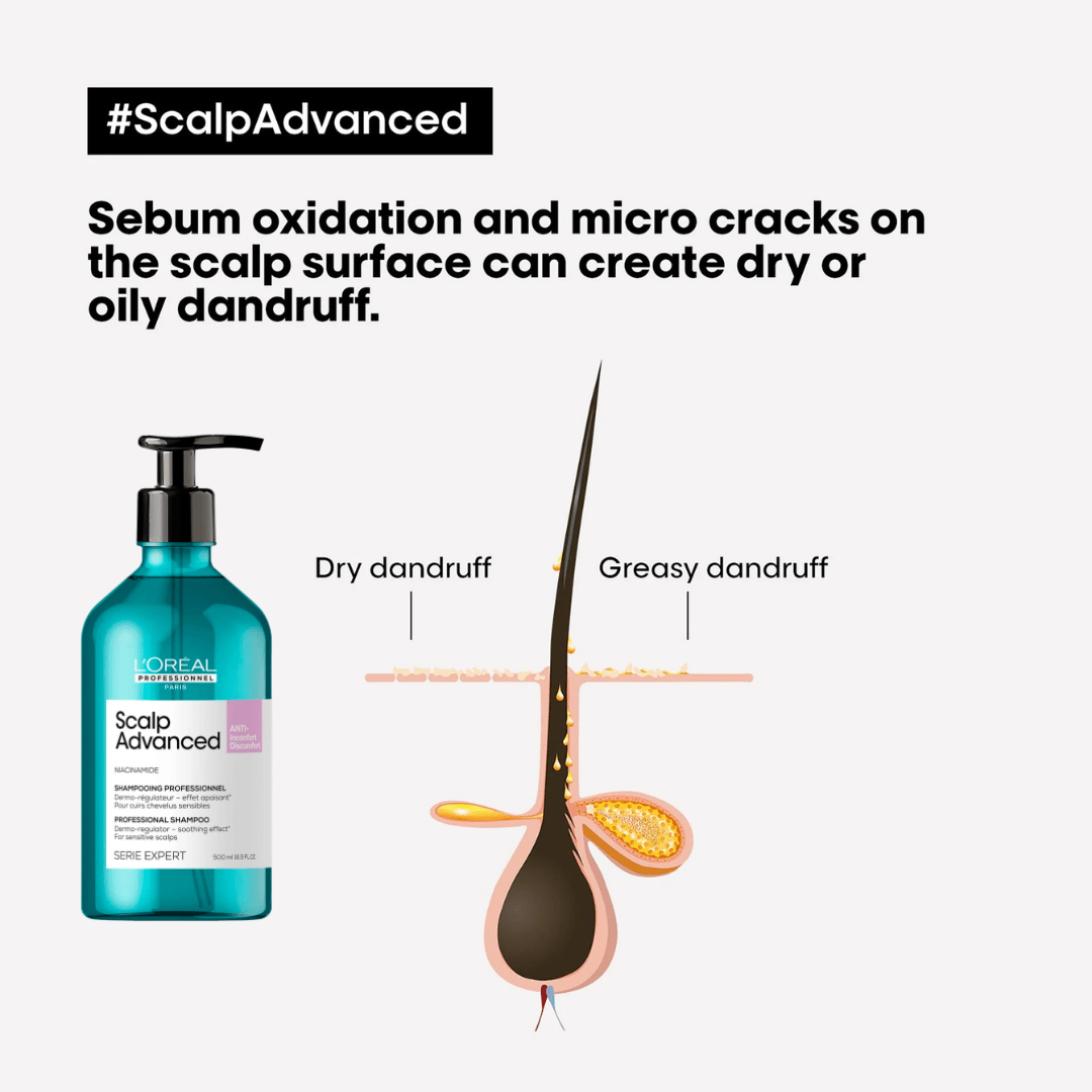 L'Oreal Professionnel_Scalp Advanced Anti-Discomfort Shampoo_Cosmetic World
