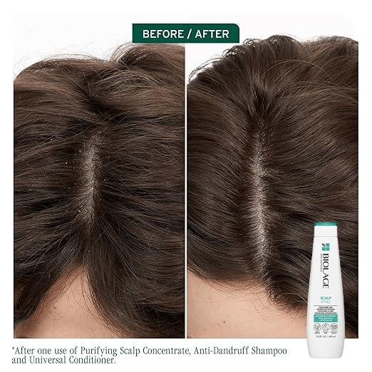 Matrix - Biolage_Scalp Sync Anti-Dandruff Shampoo_Cosmetic World