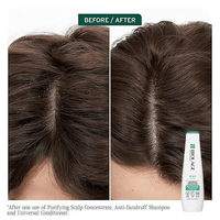 Thumbnail for Matrix - Biolage_Scalp Sync Anti-Dandruff Shampoo_Cosmetic World