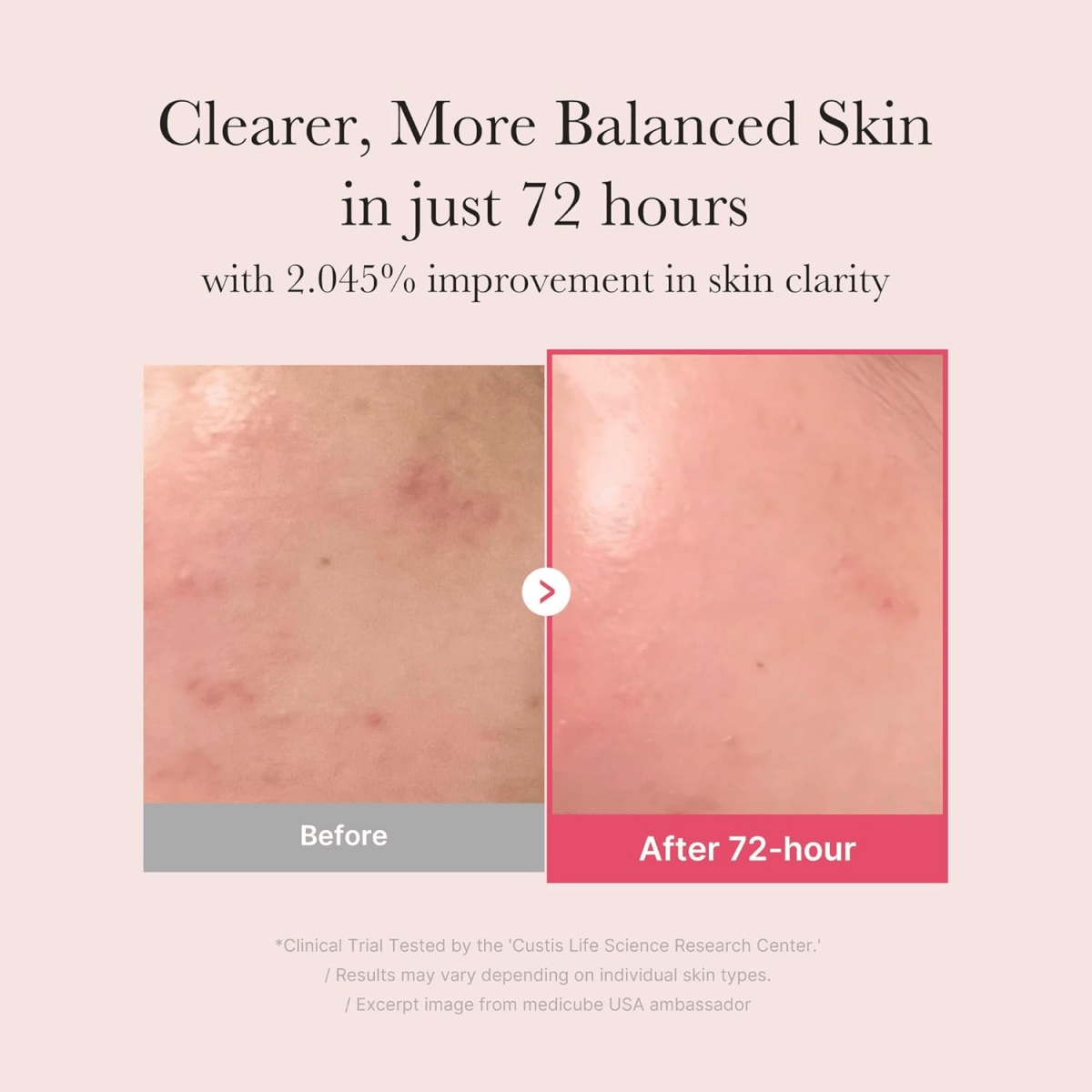 Medicube_TXA Niacinamide 15% Serum_Cosmetic World