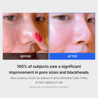 Thumbnail for MEDICUBE_Zero Pore Pad 2.0_Cosmetic World