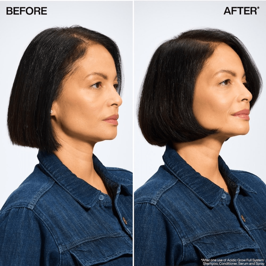 Redken_Acidic Grow Full System Scalp & Hair Serum_Cosmetic World