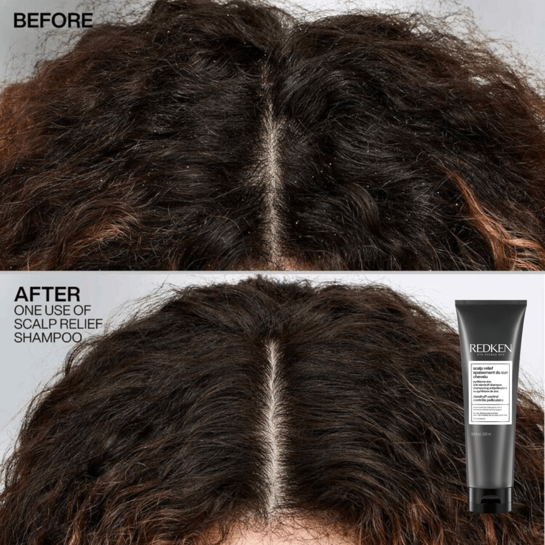 Redken_Scalp Relief Anti - Dandruff Shampoo_Cosmetic World
