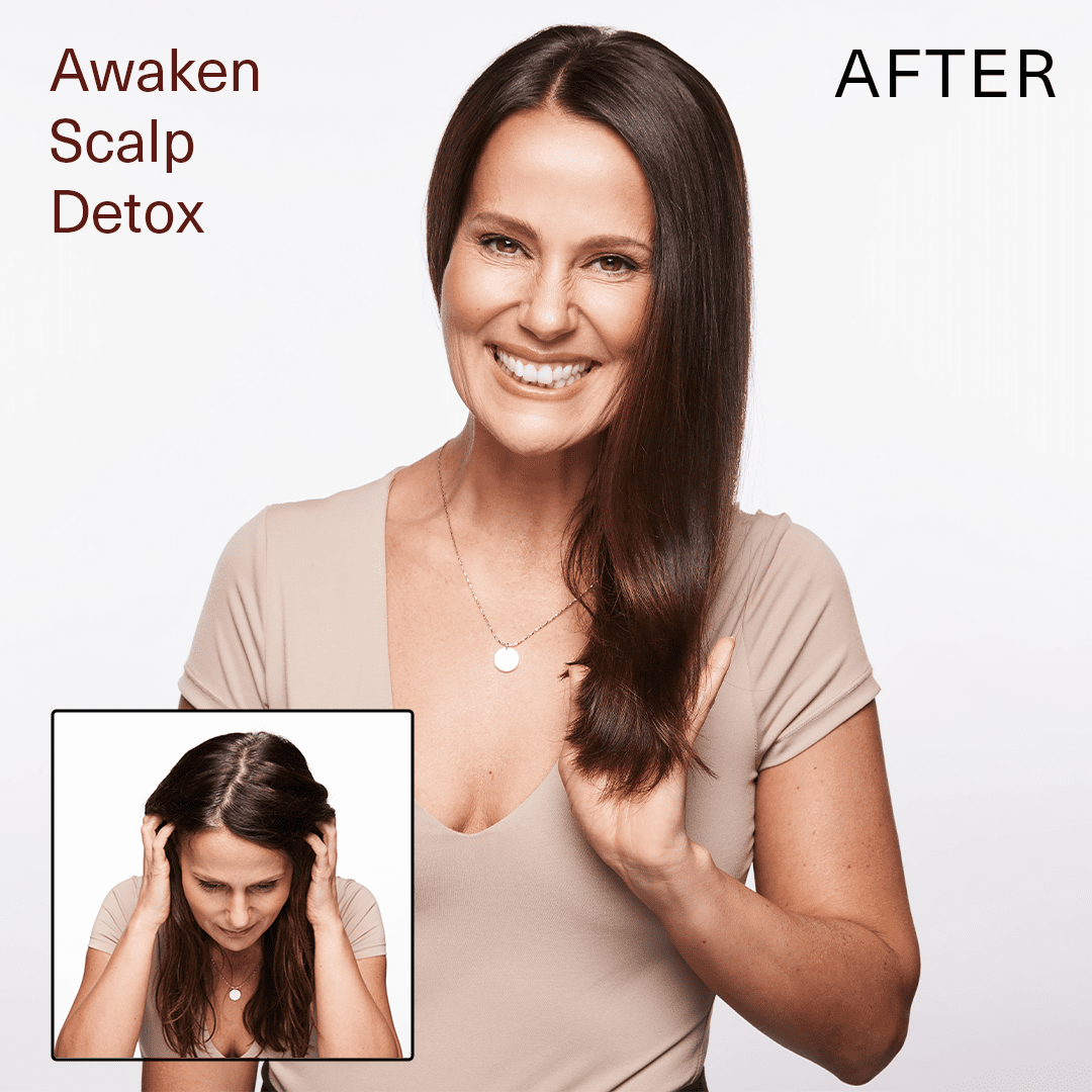 SURFACE_Awaken Scalp Detox_Cosmetic World