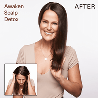 Thumbnail for SURFACE_Awaken Scalp Detox_Cosmetic World