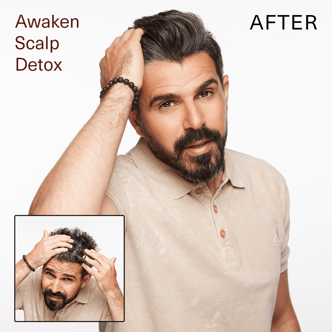 SURFACE_Awaken Scalp Detox_Cosmetic World