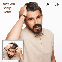 Thumbnail for SURFACE_Awaken Scalp Detox_Cosmetic World